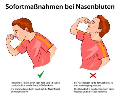 Wie H Ngen Kopfschmerzen Und Nasenbluten Zusammen