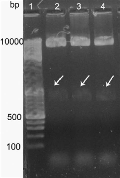 Digestion Of Recombinant Pet B Plasmid With Bamhi And Xhoi