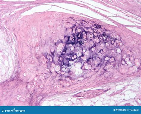 Histology Of Cartilage Human Tissue Royalty-Free Stock Photography | CartoonDealer.com #99755843