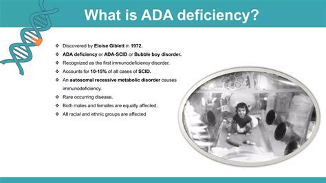 Adenosine Deaminase Deficiency Ppt