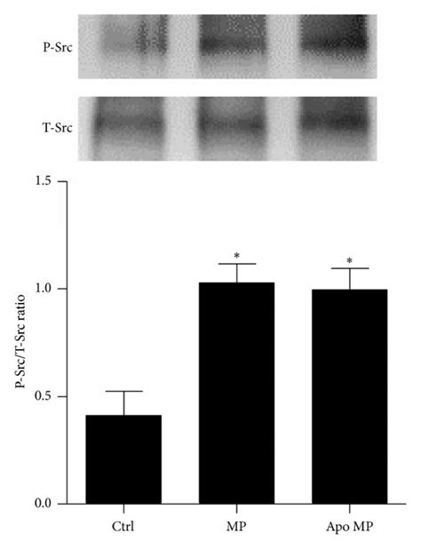 Effects Of Inhibition Of NADPH Oxidase Activity On MP Mediated Kinase