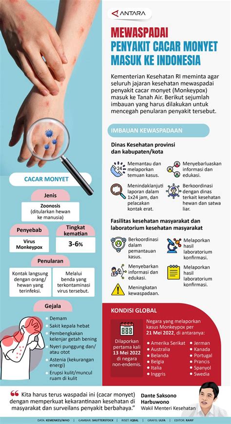 Mewaspadai Penyakit Cacar Monyet Masuk Ke Indonesia Infografik ANTARA