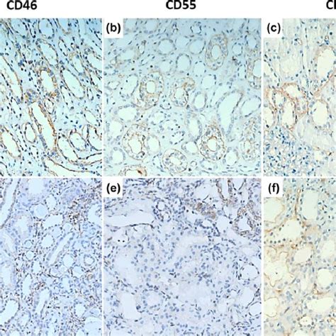 Double Immunofluorescence Staining Of Cd46 Cd55 Cd59 And Markers Of