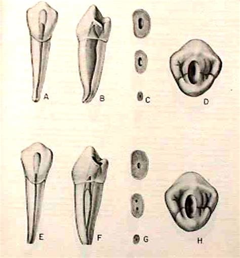 Morfología 1er premolar inferior