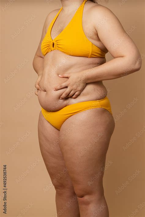 Cropped Vertical Photo Overweight Fat Naked Woman Obesity Excess Fat