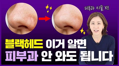 피부과 시술 없이 블랙헤드 제거하는 홈케어 방법 Youtube