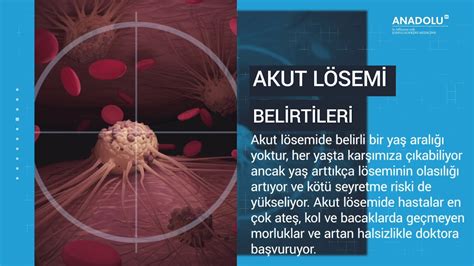 Akut lösemide nedir Akut lösemi belirtileri nelerdir YouTube