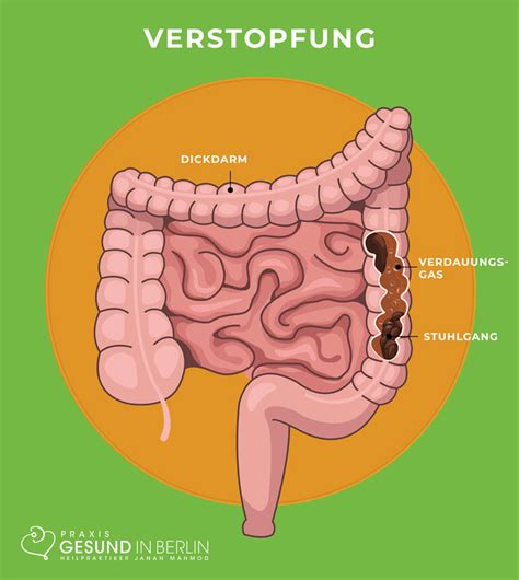 Verstopfung Naturheilpraxis Gesund In Berlin