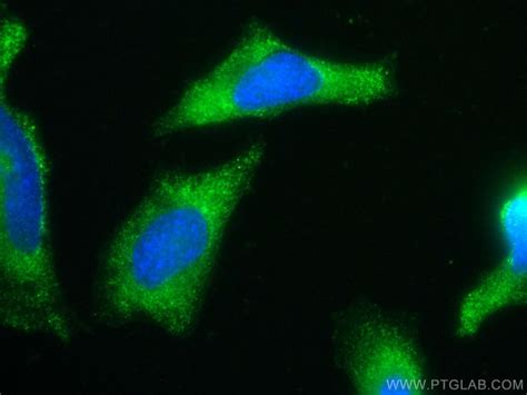 Hist Monoclonal Antibody E A Coralite Proteintech L