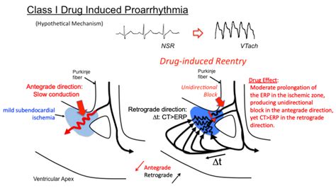 Introtoantiarrhythmics Tusom Pharmwiki Adrenergic Receptors