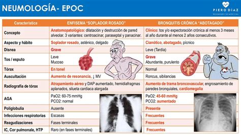 Bronquitis Vs Enfisema Epoc Pierodiaz Med Epoc Bronquitis Udocz