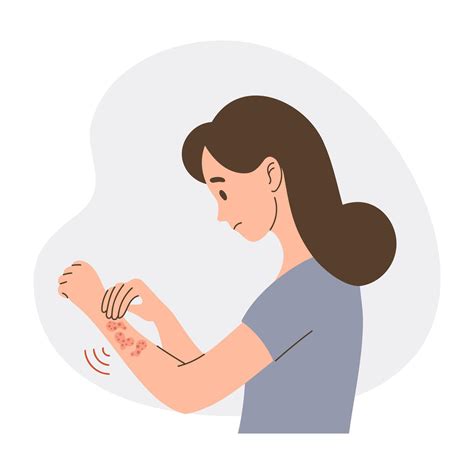 Woman with itchy skin rash. Allergic itching, skin inflammation