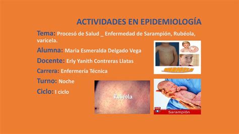 Proceso De Salud Y Enfermedad Sarampi N Rub Ola Varicela Maria