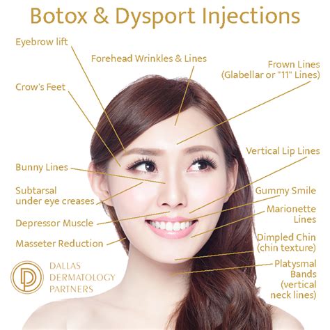 Is Dysport As Good As Botox Dallas Dermatology Partners