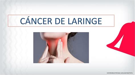 CÁNCER DE LARINGE 1 Catherine Tarazona uDocz