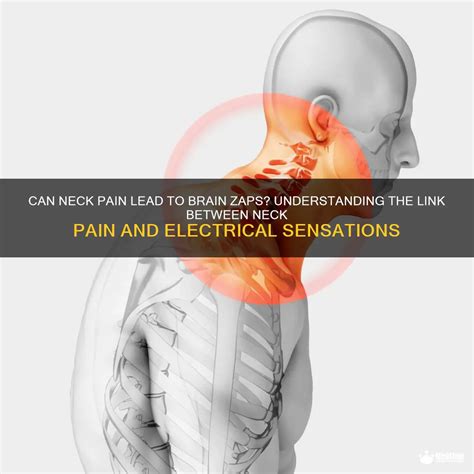 Can Neck Pain Lead To Brain Zaps Understanding The Link Between Neck Pain And Electrical