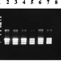 Sensitivity Of The Nested PCR A Electrophoretic Analysis Of PCR