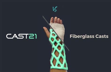 Cast21 The Revolutionary Technology For Treating Broken Bones