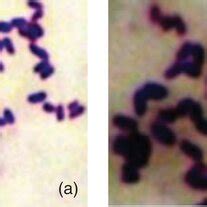 Gram stain of Corynebacterium pseudotuberculosis from caseous... | Download Scientific Diagram