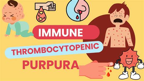 Mastering Immune Thrombocytopenic Purpura Itp Pathophysiology Symptoms Diagnosis