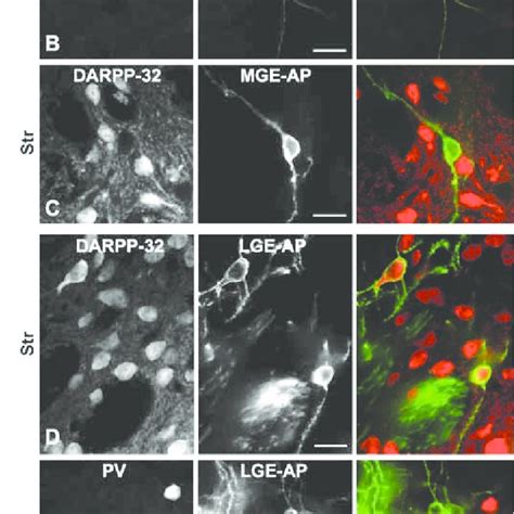 Immunohistochemical Characterization Of Grafted MGE A C And LGE D F