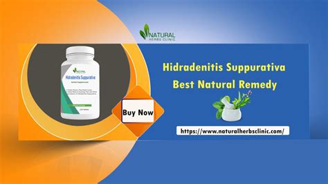 3 Effective Hidradenitis Suppurativa Treatment Home Remedies