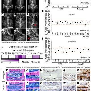 Adult Sox9 Del Del Mutant Mice Display IVD Defects Of The Spine A F