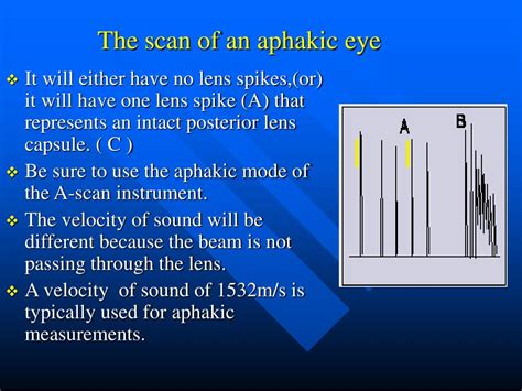 Ppt A Scan Biometry Powerpoint Presentation Free Download Id6217791