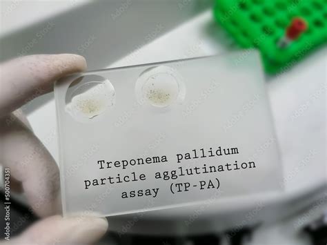 RPR VDRL Syphilis Test Glass Slide Agglutination Method Treponema