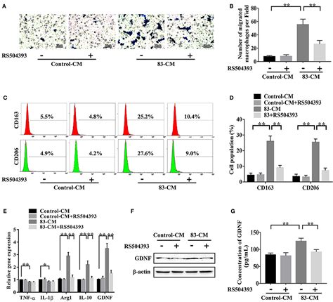 Frontiers Ccl2ccr2 Axis Promotes The Progression Of Salivary Adenoid