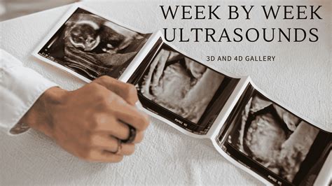 Week by Week Gallery of 3D/4D Ultrasound | MindTastik