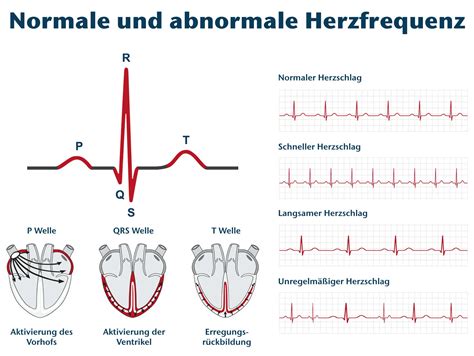 Elektrokardiographie Durchführung und Analyse eines EKG