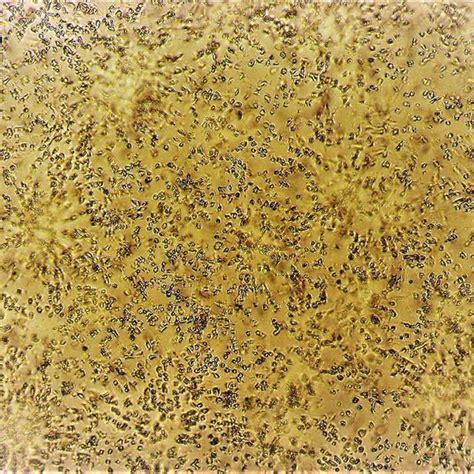 Normal Vero Cells Monolayer A Vero Cell Monolayer Infected With