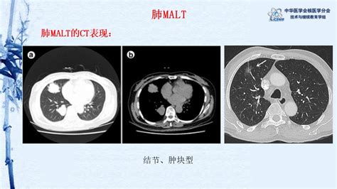 Malt Pet Ct Csnm