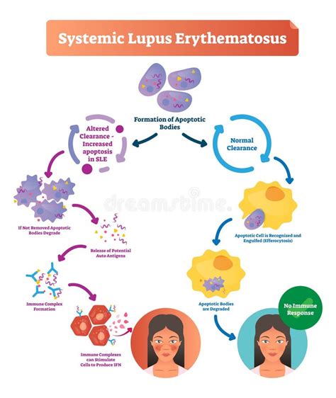 Lupus Ryth Mateux Diss Min Illustration De Vecteur Illustration Du