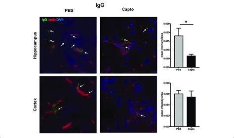 Oral Captopril Reduces Igg Deposition In The Brain Frozen Brains