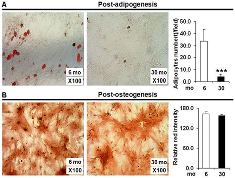 Age Associated Changes In Adipogenic Or Osteogenic Differentiation