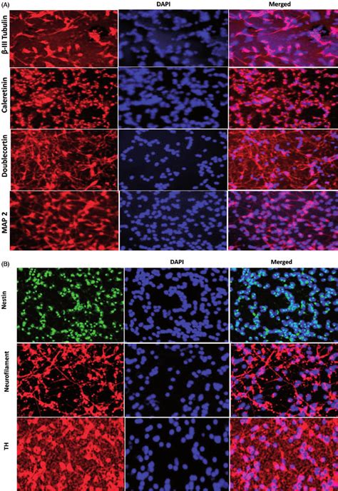 Expression Of Neuron Specific Proteins In Differentiated Cells