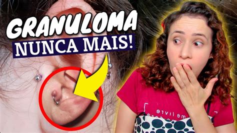 Como Cuidar Pra N O Nascer Queloide No Piercing Da Orelha Youtube