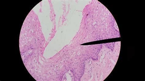 We Heart Anatomy Vagina Stratified Squamous Non Keratinized