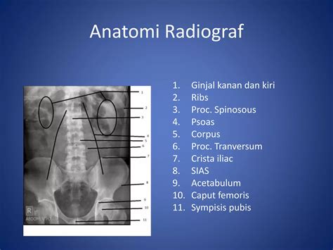 Ppt Kritisi Dan Evaluasi Radiograf Ivp Dan Cystografi Ppt