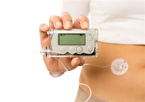 Get In The Know Continuous Glucose Monitors CGM And Insulin Pumps