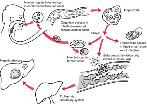 Intestinal Amebiasis Definition Of Intestinal Amebiasis By Medical Dictionary