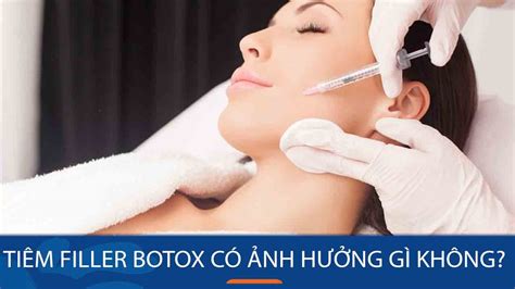 Tiêm filler botox có ảnh hưởng gì không Lợi ích tác dụng phụ và lưu ý