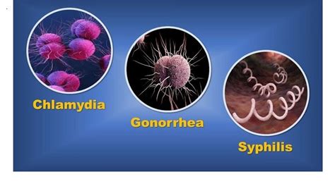 Dr C’s Journal What Are Symptoms Of Gonorrhea Doctors Without Waiting Rooms