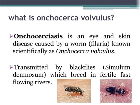 Onchocerca Volvulus River Blindness Ppt Download