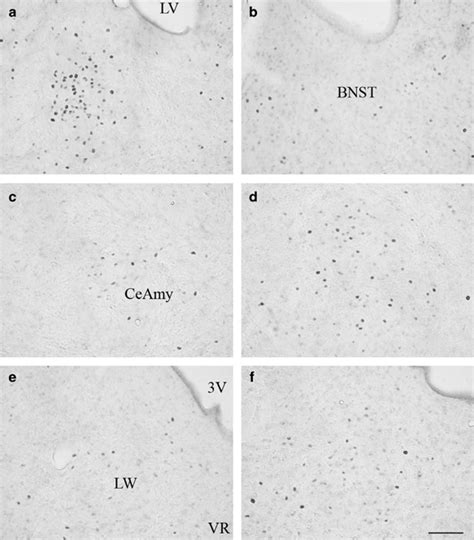 Photomicrographs Of CFOS Expression In Three Brain Regions In