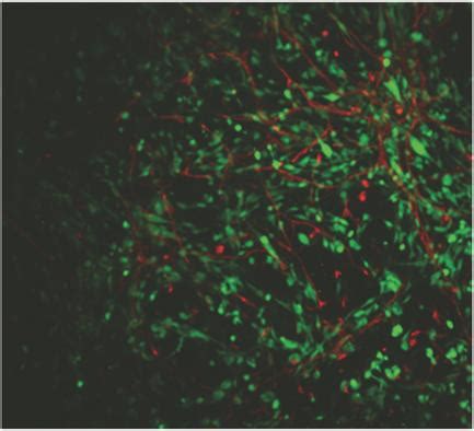 The Influence Of Hyaluronic Acid And Glioblastoma Cell Coculture On The