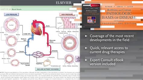 Watch Robbins and Cotran Pathologic Basis of Disease Professional ...