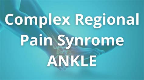 Complex Regional Pain Syndrome Ankle Crps Treatment